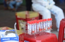 Вьетнам усиливает потенциал тестирования на вирус SARS-CoV-2