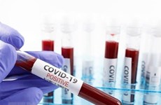 ВОЗ сочла коронавирус в десять раз смертельнее свиного гриппа
