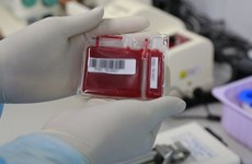 Возможность для многих местных родителей сохранить стволовые клетки пуповинной крови своего ребенка