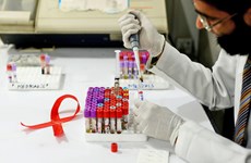 Тяжелая борьба с пандемией ВИЧ / СПИДа