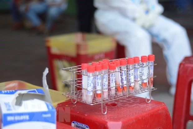 Вьетнам усиливает потенциал тестирования на вирус SARS-CoV-2 hinh anh 1