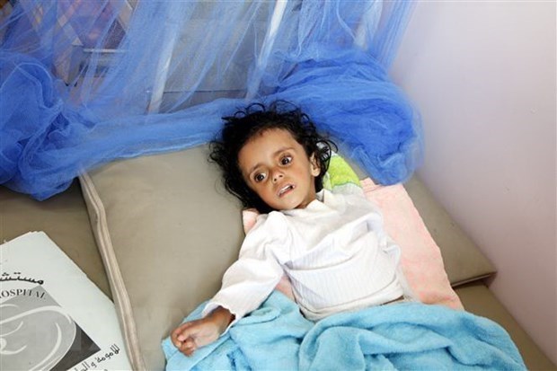 Вьетнам призывает объединить усилия для предотвращения голода в Иемене hinh anh 1