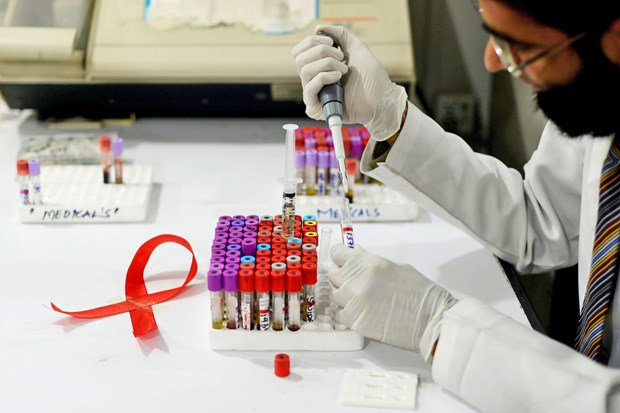 Тяжелая борьба с пандемиеи ВИЧ / СПИДа hinh anh 1